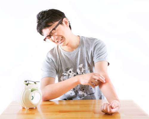 蚊に刺された人の写真